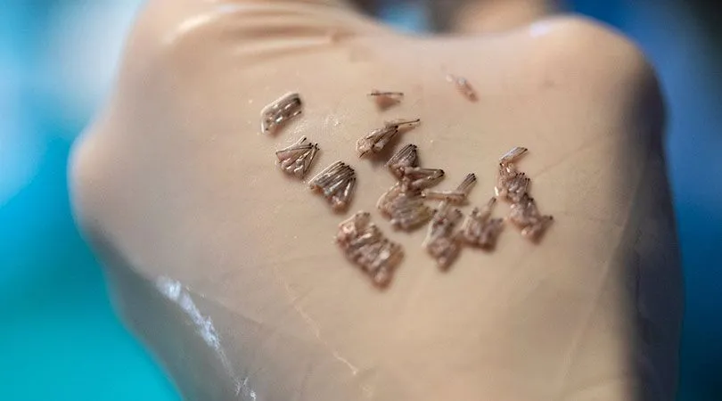 FUE Haartransplantation Grafts – präzise Entnahme und Transplantation einzelner Haarfollikel für ein dichtes, natürliches Ergebnis