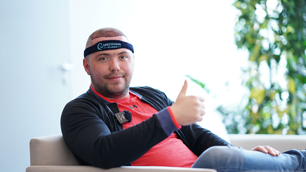 FUE Haartransplantation bei einem Patienten – minimalinvasives Verfahren mit präziser Entnahme und natürlichem Haaransatz