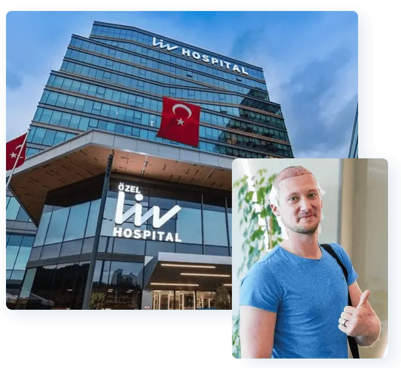 Haartransplantation in der Türkei im Liv Hospital – moderne Technik, erfahrene Ärzte und hochwertige medizinische Betreuung