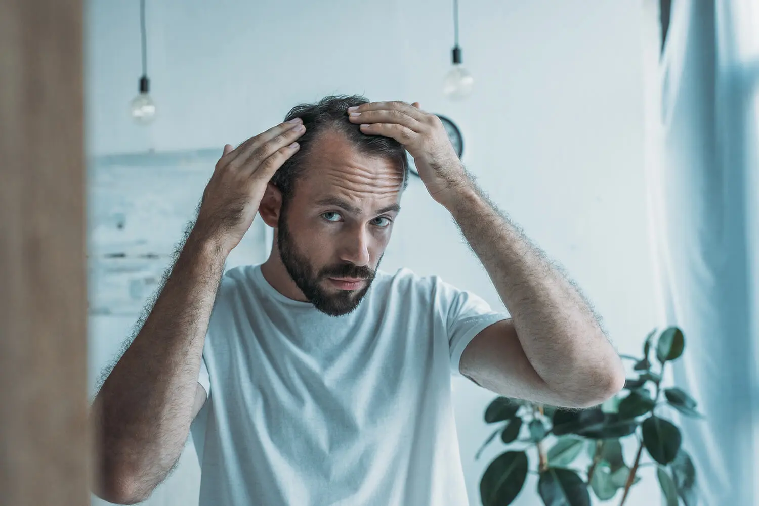 Wichtige Aspekte vor der Haartransplantation – Beratung, Haarausfallanalyse und realistische Erwartungen