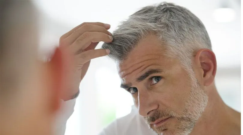 Wann transplantierte Haare nach einer Haartransplantation wachsen – erste Ergebnisse ab Monat 3, volles Ergebnis nach 9–12 Monaten