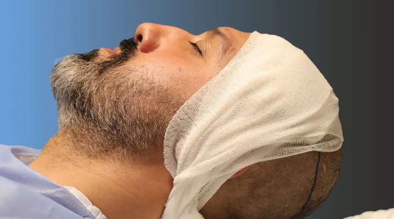 Was verursacht Krusten nach einer Haartransplantation – natürliche Heilungsreaktion durch Mikroverletzungen bei der Graft-Implantation