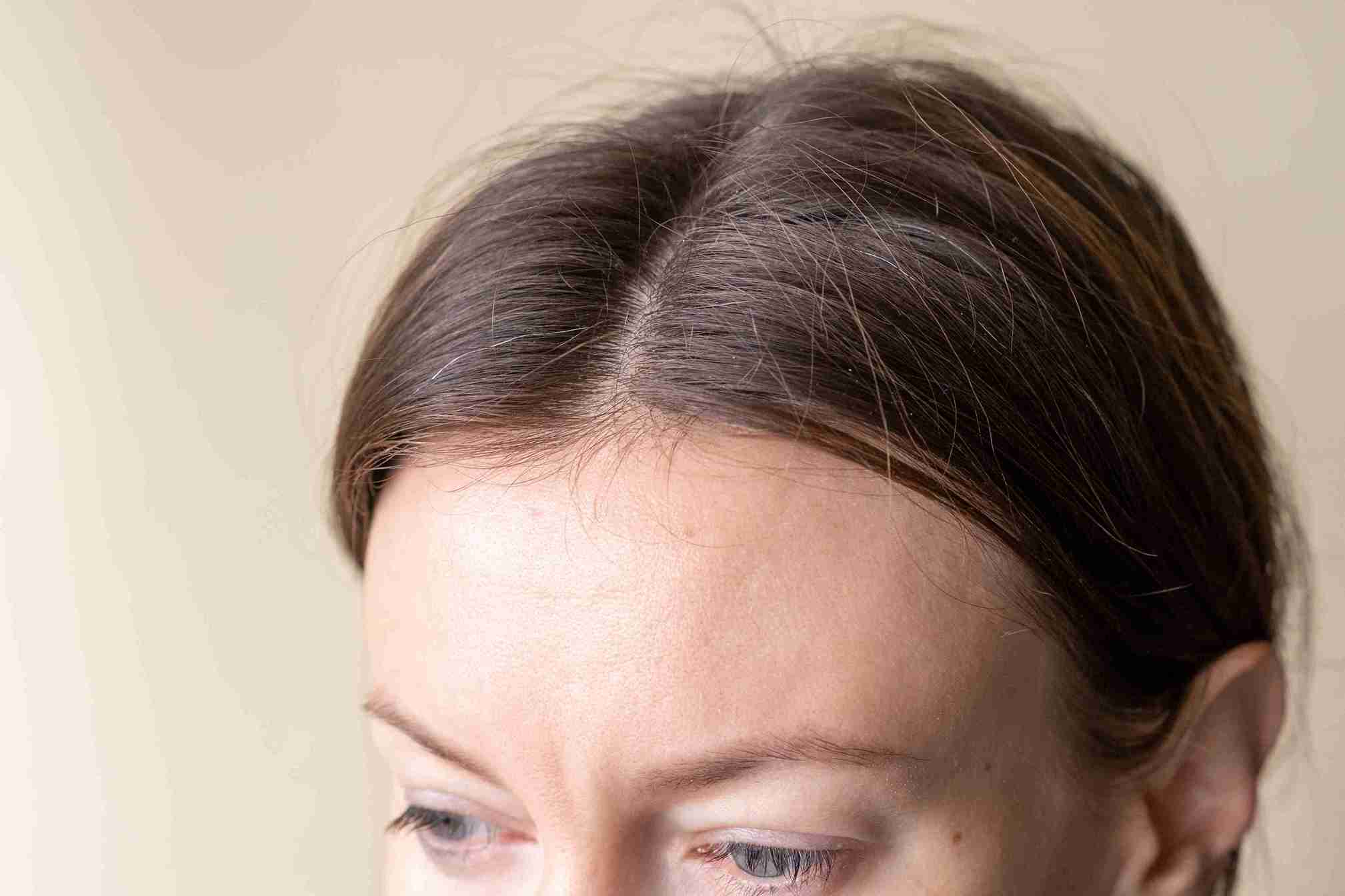 Nahaufnahme einer Frau mit Mittelscheitel – Beispiel für Frauen mit hoher Stirn und zurückgehendem Haaransatz.