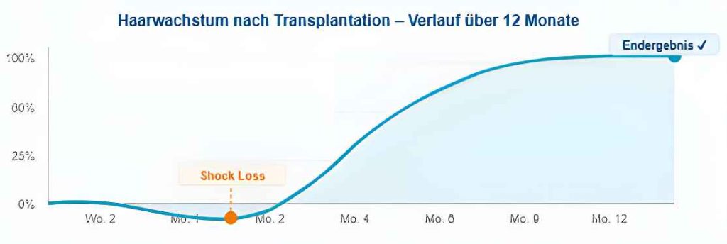 12 Monats Kurve die den Verlauf des Haarwachstums zeigt.