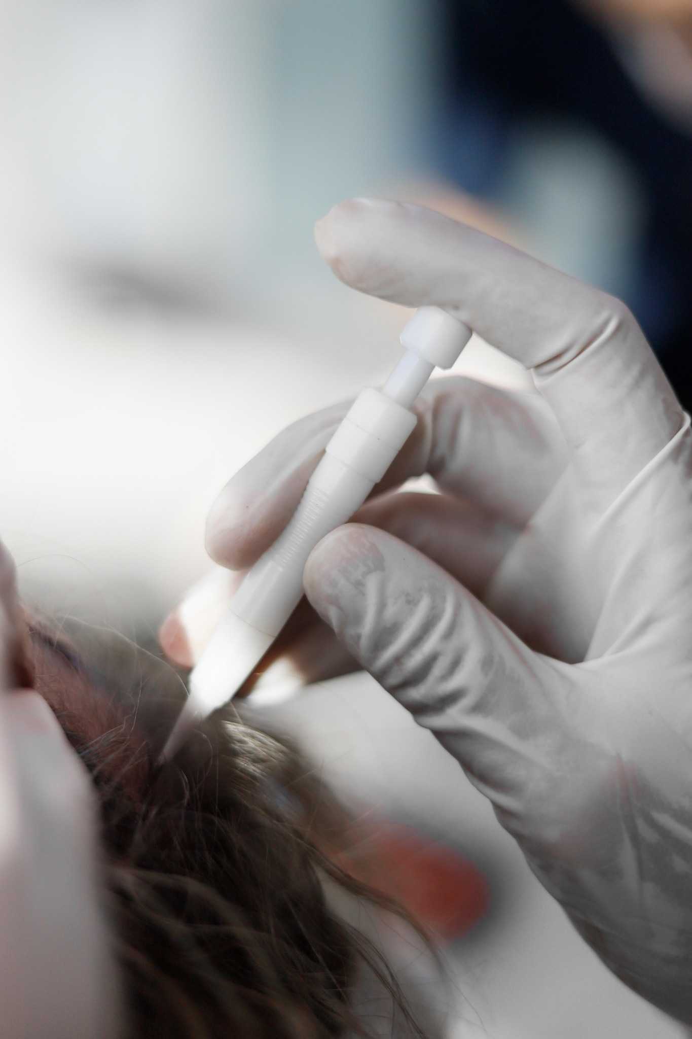 Haartransplantation bei Frauen mit schonender DHI Technik