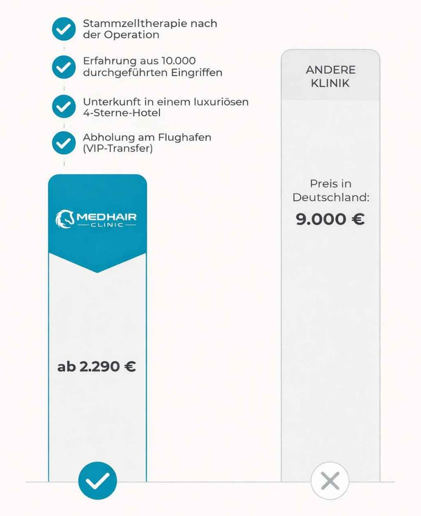 Haartransplantationspreis – Kosten abhängig von Graft-Anzahl, Methode (FUE, DHI) und Klinikstandort, z. B. Türkei oder Deutschland