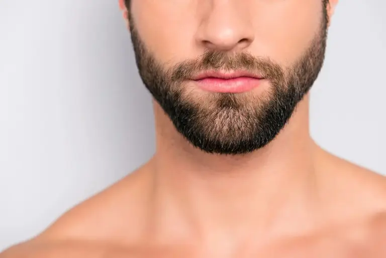 Beard transplant procedure at MedHair Clinic in Istanbul, Turkey for natural facial hair restoration