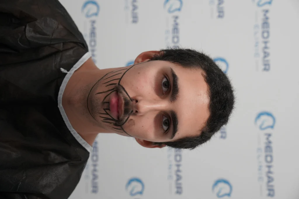 sakal ekimi 2