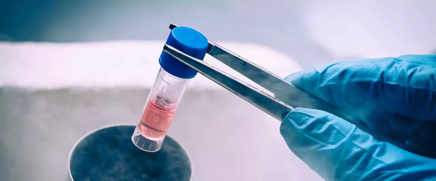 svf kok hucre tedavisi 68b02719c5e94