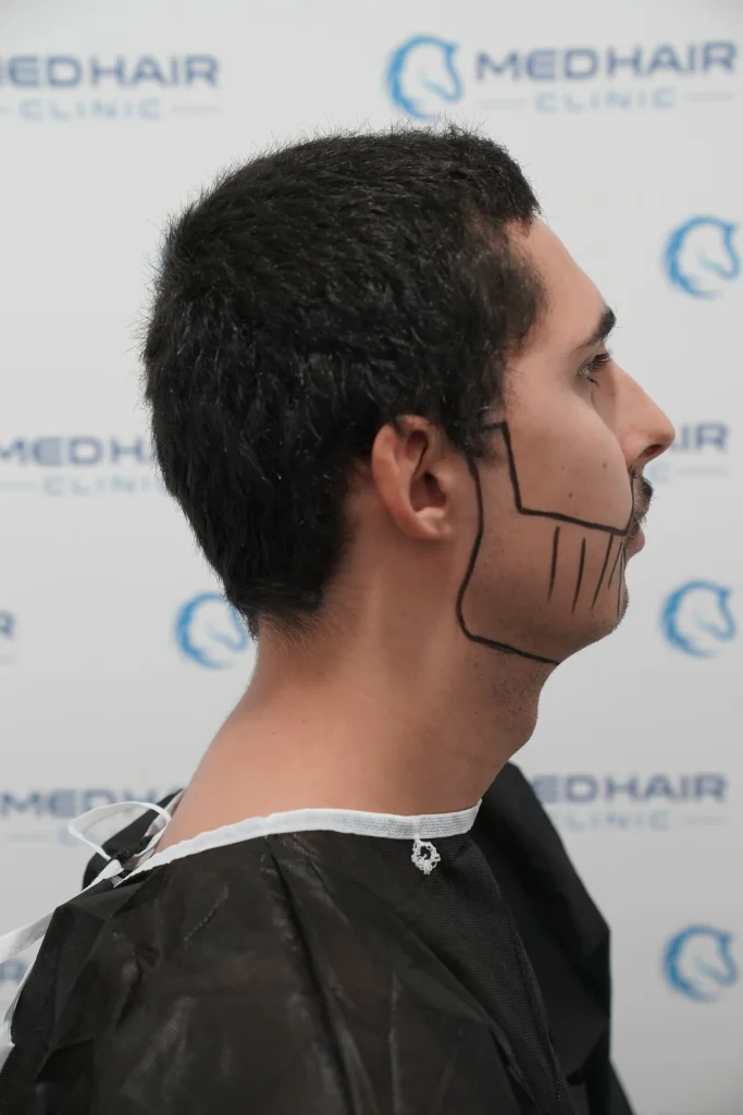 sakal ekimi 4 scaled e1756714630978