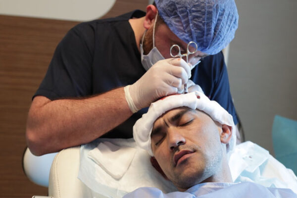 Ekilen Saçlar Ne Zaman Çıkar?