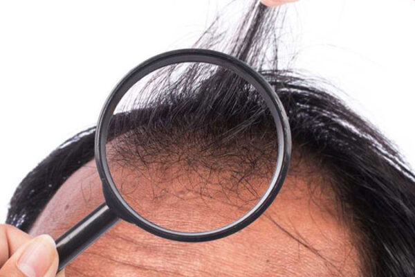 Saç Ekim Öncesi Kurallar