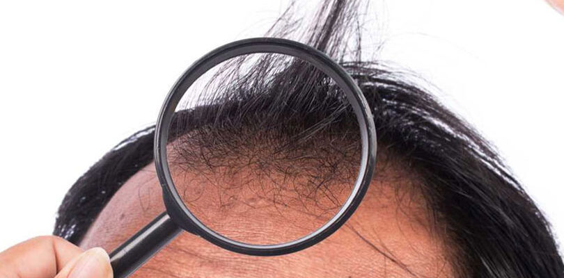 Saç Ekim Öncesi Kurallar