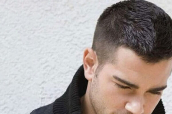 Saç Ekimi Sonrası Kurallar