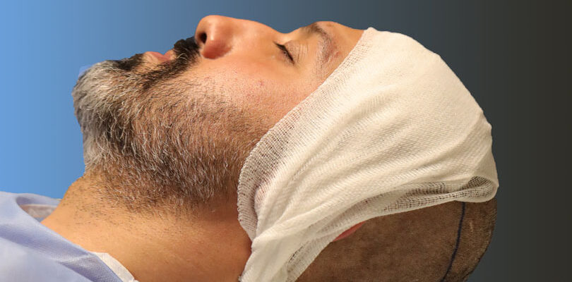 Saç Ekimi Sonrası Kabuklar Nasıl Temizlenir?