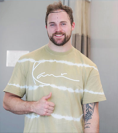 Greffe de Cheveux Turquie