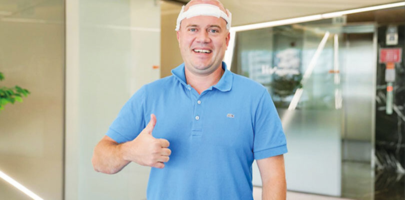 Saç Ekimi Sonrası Uyuma