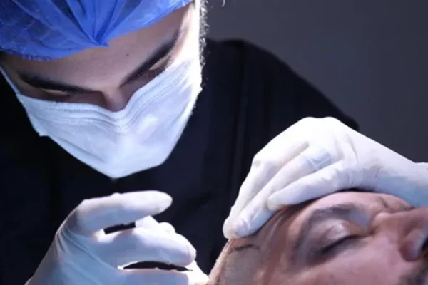 La Greffe De Cheveux Est-Elle Une Procédure Douloureuse?