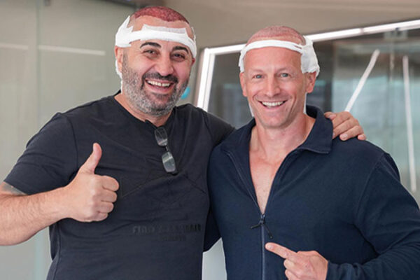 Saç Ekimi Sonrası Sigara Kullanımı