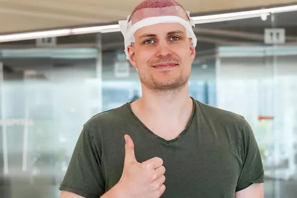 Greffe de Cheveux Turquie Prix