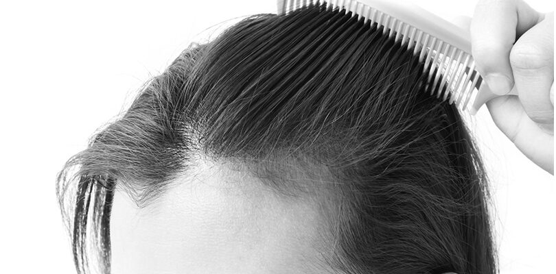 hamilelikte saç dökülmesi