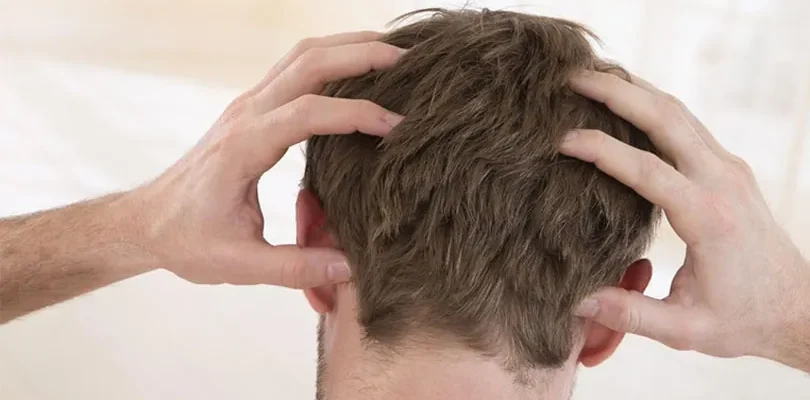 How does itching go away after hair transplantation