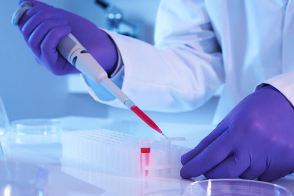 Kök Hücre Saç Tedavisi