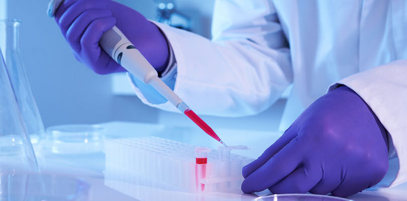 Kök Hücre Saç Tedavisi