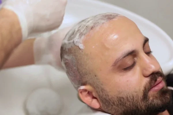 Post Operatif Saç Yıkama