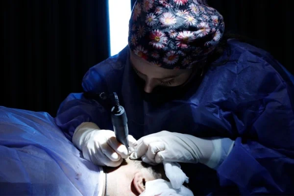 Saç Ekimi İşlemi Nasıl Yapılır?