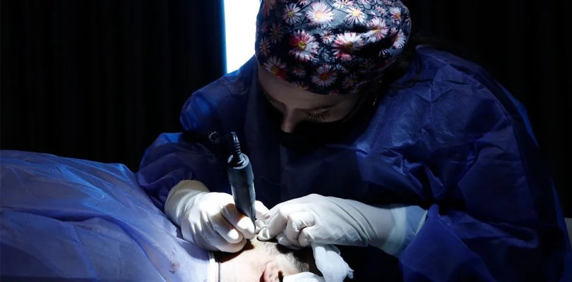 saç ekimi nasıl yapılır