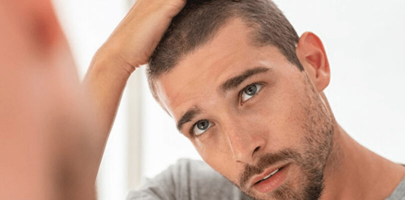 saç ekimi olup pişman olur muyum