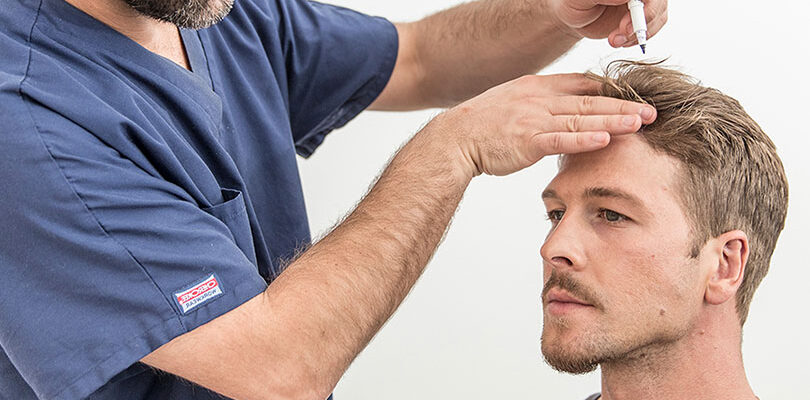 Saç Ekimi Sonrası Ödem