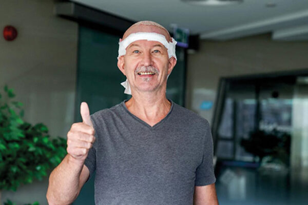 Saç Ektirenler Neden Bant Takar?