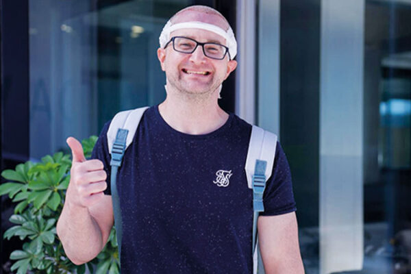 Terlemek Saç Ekimine Zarar Verir mi?