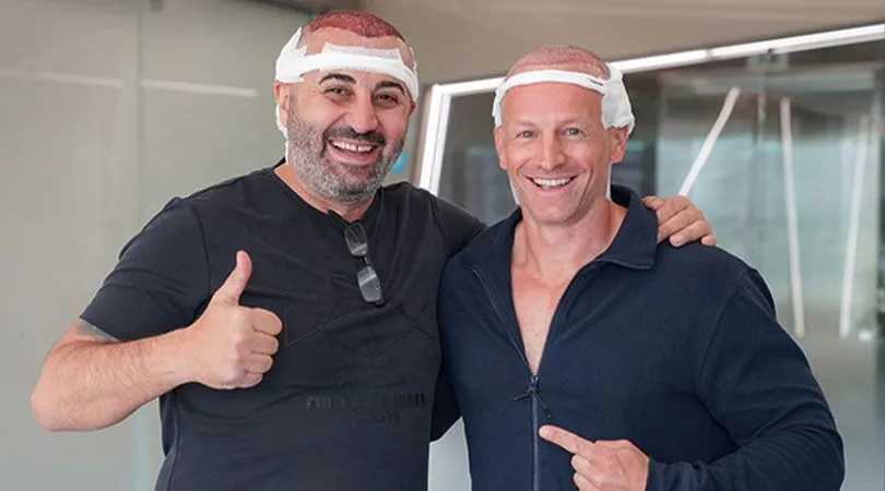 FUE hair transplant – minimally invasive follicular unit extraction technique for natural hair restoration