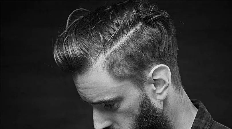 What is the best hair transplant technique – FUE, DHI, or Sapphire FUE at MedHair Clinic in Istanbul, Turkey