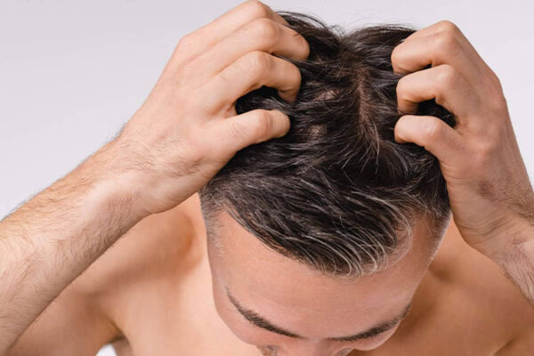 Saç Dipleri Neden Ağrır?