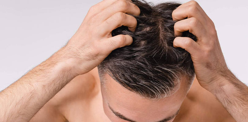 Saç Dipleri Neden Ağrır?