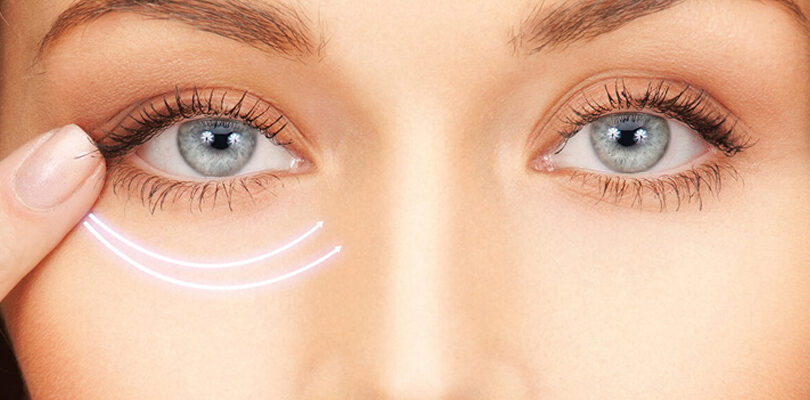 gözaltı ışık dolgusu