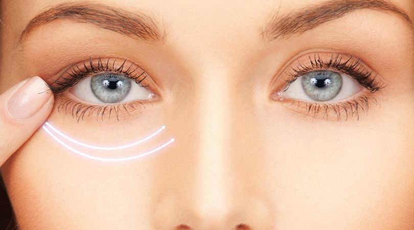 Göz Altı Işık Dolgusu