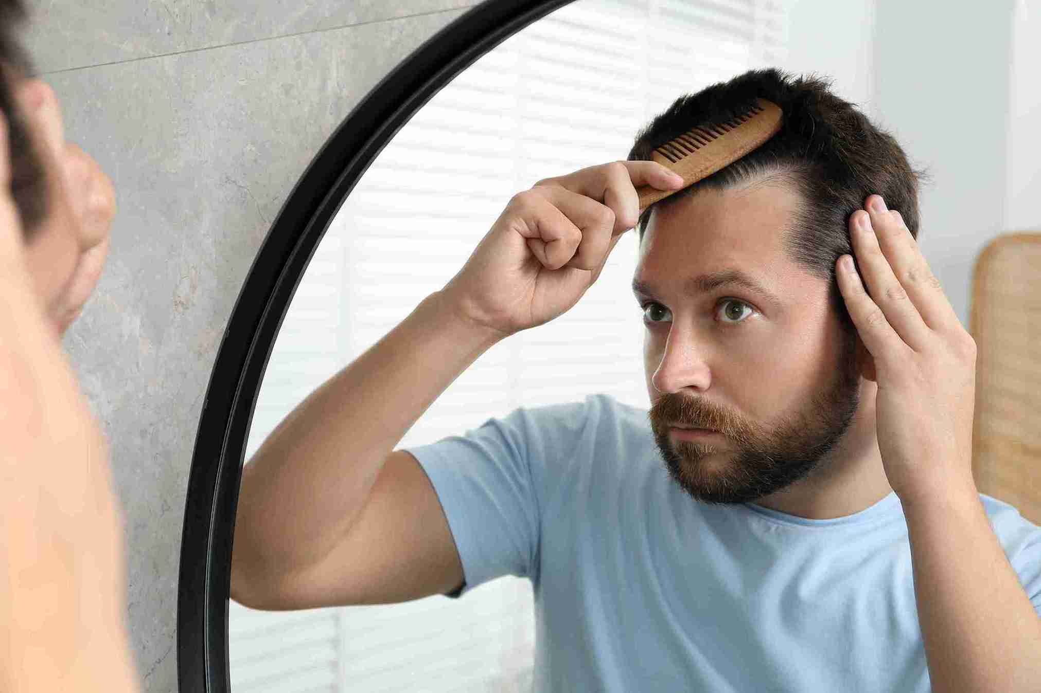 Mann betrachtet im Spiegel seine Haarlinie und kämmt die Haare, um Geheimratsecken auffüllen und Haarausfall kaschieren zu können.
