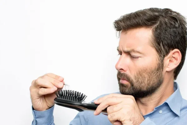 Cause Della Perdita Dei Capelli