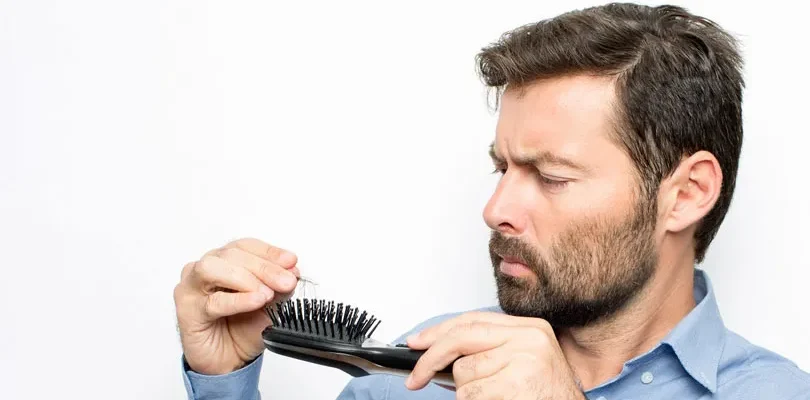 Cause Della Perdita Dei Capelli