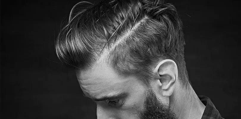 Qual è La Tecnica Migliore Per Il Trapianto Di Capelli?