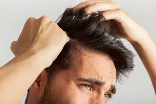 Trattamento Per La Caduta Dei Capelli