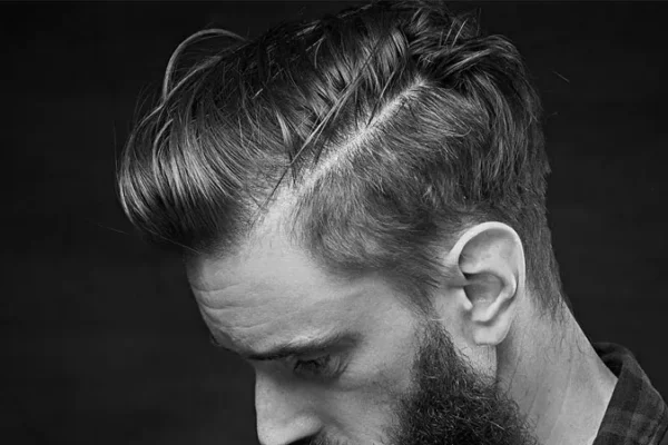 Y Aura-T-Il Une Perte De Cheveux Après La Greffe De Cheveux?