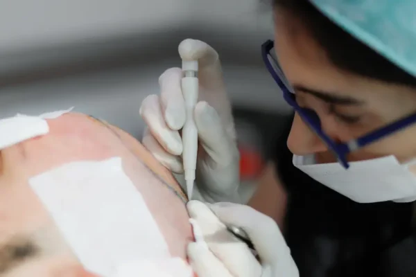 Skeen İle Saç Greftlerini Sayma ve Ölçme