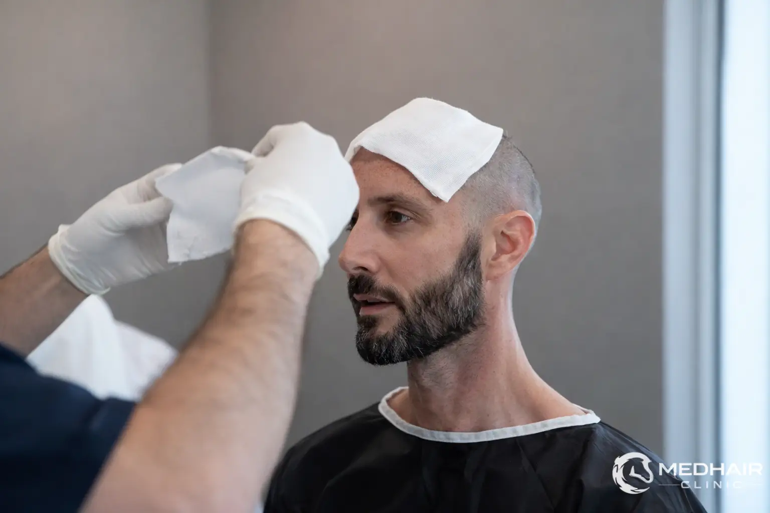 Hair Transplant in One of The Top Rated Clinics İn Turkey