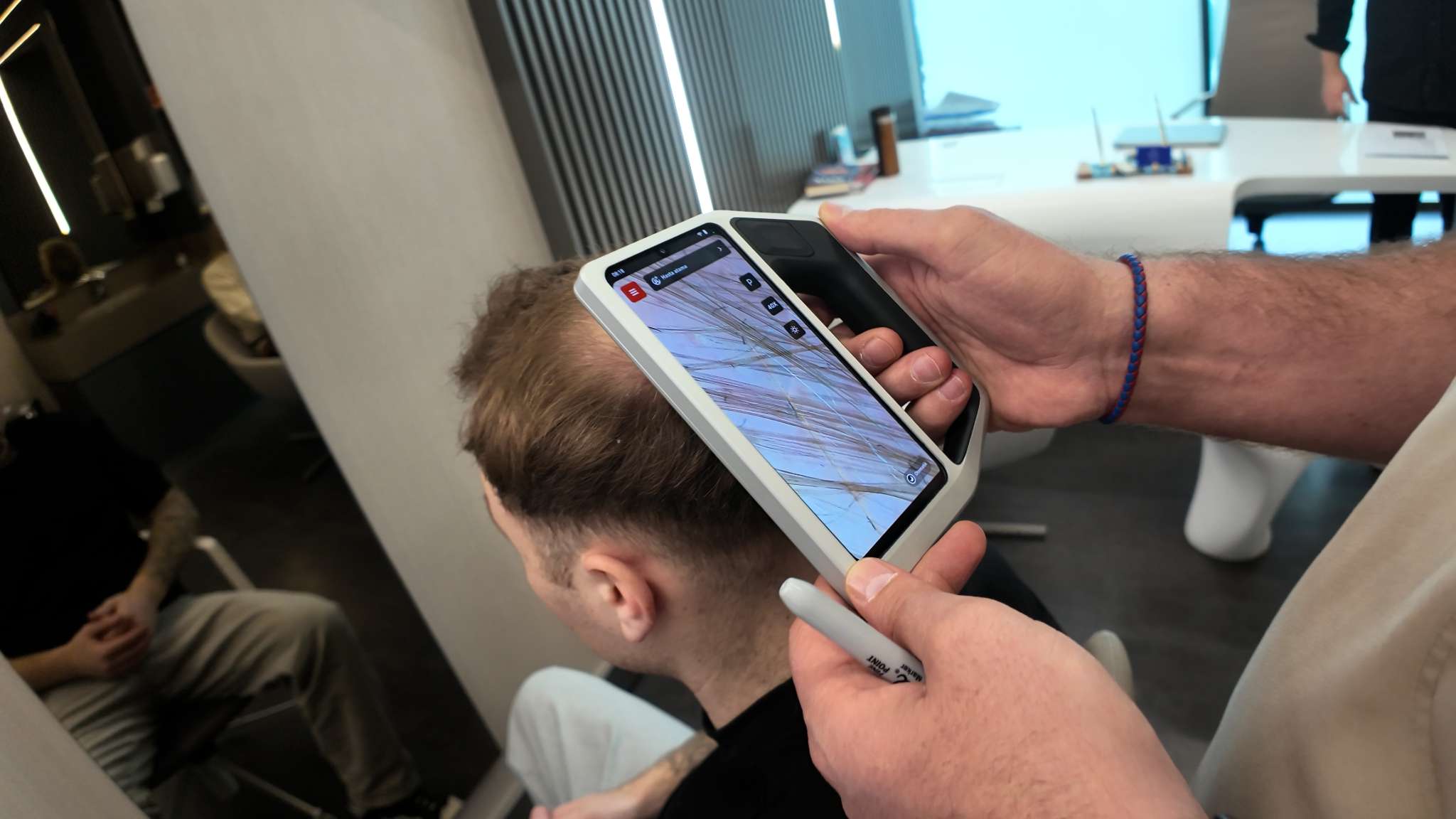KI-gestützte Haaranalyse eines Patienten zur Diagnose von Haarausfall in der MedHair Clinic
